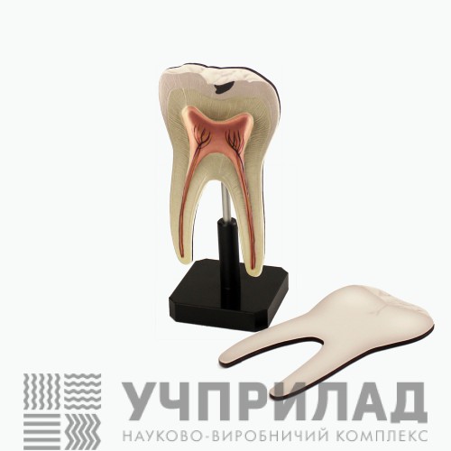 Модель " Будова зуба людини"